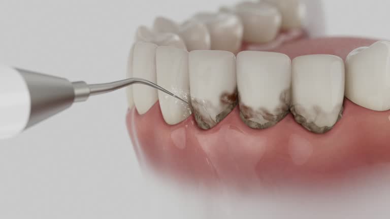 Trusted Wisdom Tooth Removal service in Bowmansville, PA - Dentist Open Now